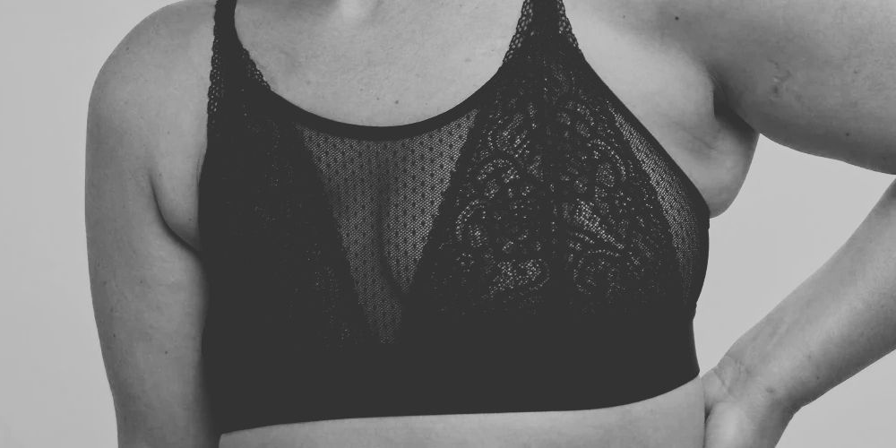Uneven Breasts: Why Do They Happen?