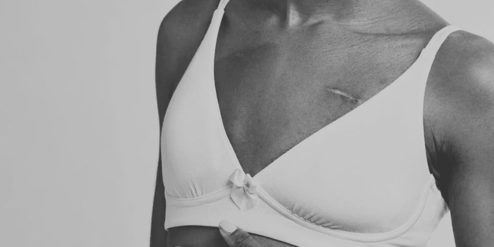Bra for Asymmetric Breasts